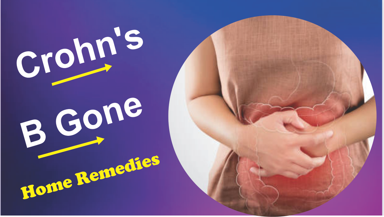 Chrohn's B disease alternative treatment