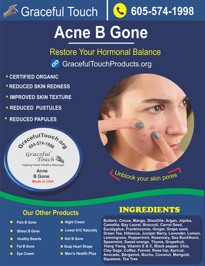 Acne Be Gone Face Cream | Acne B Gone Cream | GracefulTouchLLC