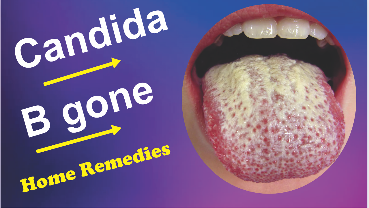 Candida alternative solution