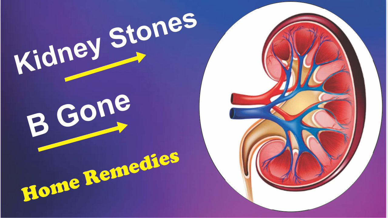 Kidney stones home remedy