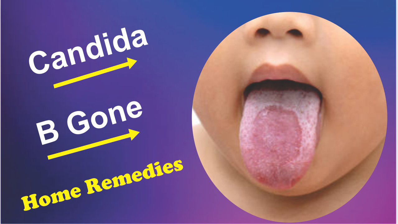 Dynamic Candida Cream Design for Your Screen Dynamic Candida Cream Design for Your Screen