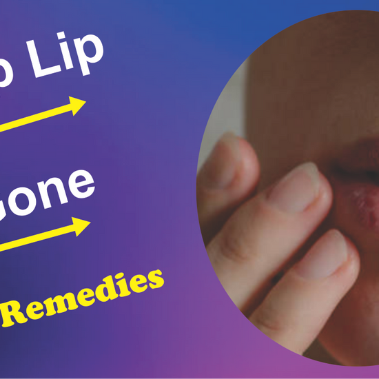 Chap lip alternative treatment