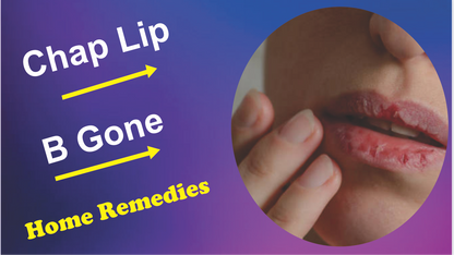 Chap lip alternative treatment
