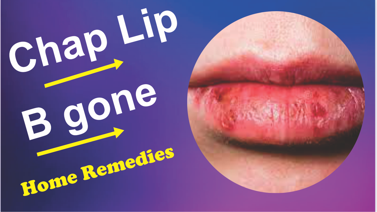 Chap lip alternative solution